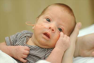 Newborn baby with a feeding tube in striped onesie supported by an adult hand.